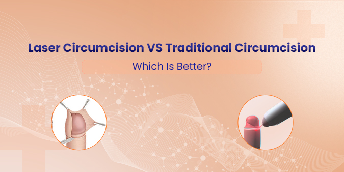Laser Circumcision vs. Traditional Circumcision: Which Is Better?